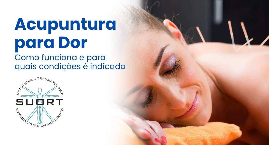 Acupuntura para Dor em Perdizes São Paulo - SUORT Clínica Integrada