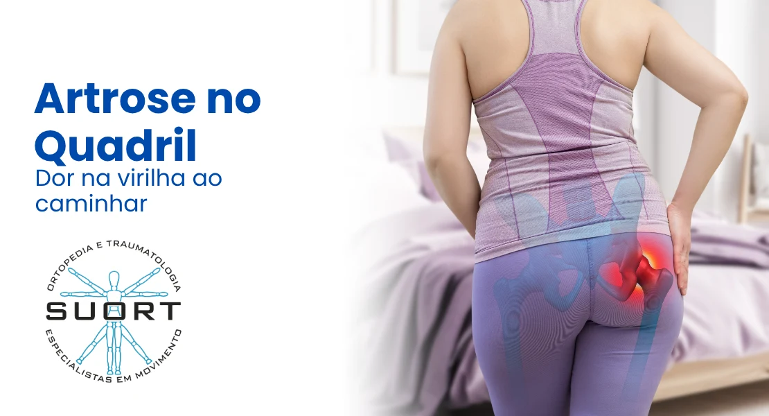 Artrose no quadril (coxartrose), dor na virilha ao caminhar, avaliação com ortopedista e fisioterapia na SUORT Clínica Integrada, Perdizes, São Paulo