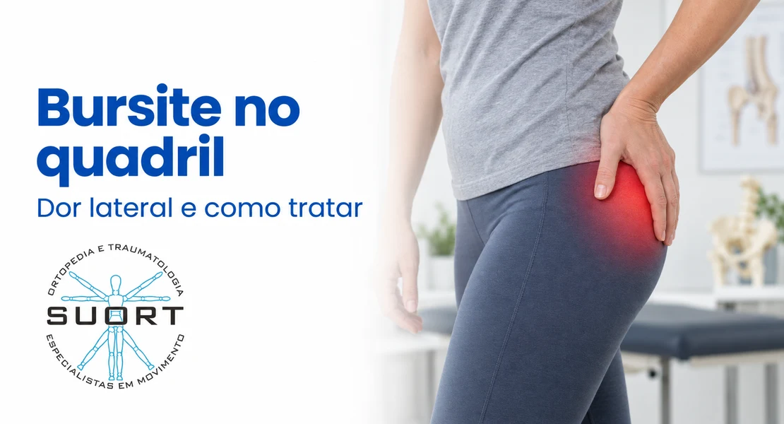 Bursite no quadril, dor lateral que piora ao deitar de lado, avaliação com ortopedista e fisioterapia na SUORT Clínica Integrada, Perdizes, São Paulo