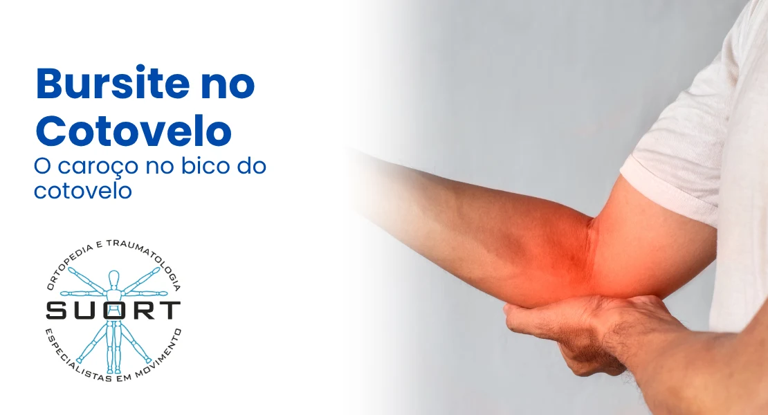 Bursite no cotovelo, inchaço no bico do cotovelo, avaliação com ortopedista de cotovelo e fisioterapia na SUORT Clínica Integrada, Perdizes, São Paulo