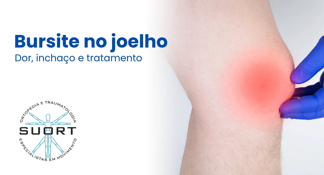 Bursite no joelho, tratamento da dor e do inchaço com ortopedista e fisioterapia com convênio em Perdizes, São Paulo