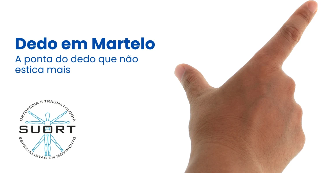 Dedo em martelo, ponta do dedo caída por lesão do tendão extensor, avaliação com ortopedista da mão e fisioterapia na SUORT Clínica Integrada, Perdizes, São Paulo