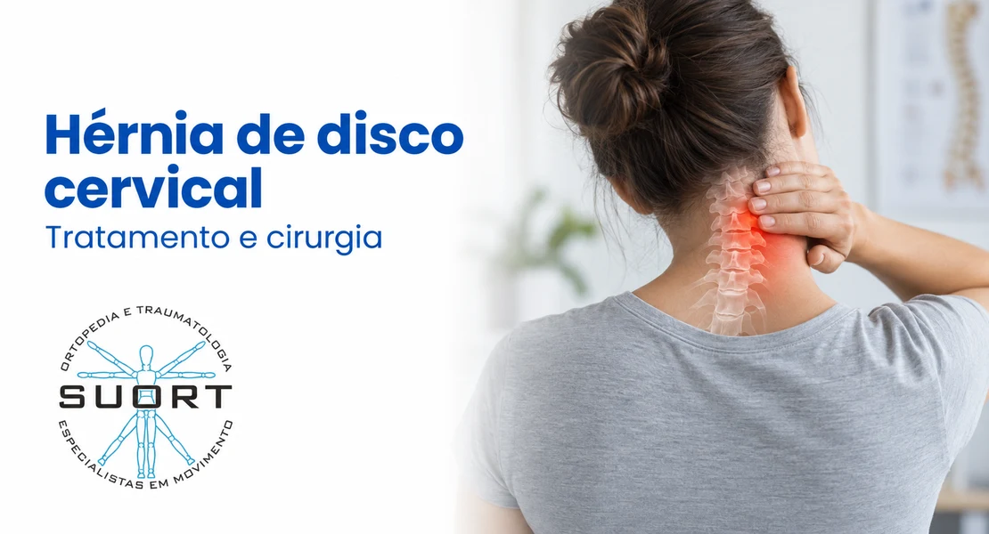 Hérnia de disco cervical, dor no pescoço que irradia para o braço, avaliação com ortopedista e fisioterapia na SUORT Clínica Integrada, Perdizes, São Paulo