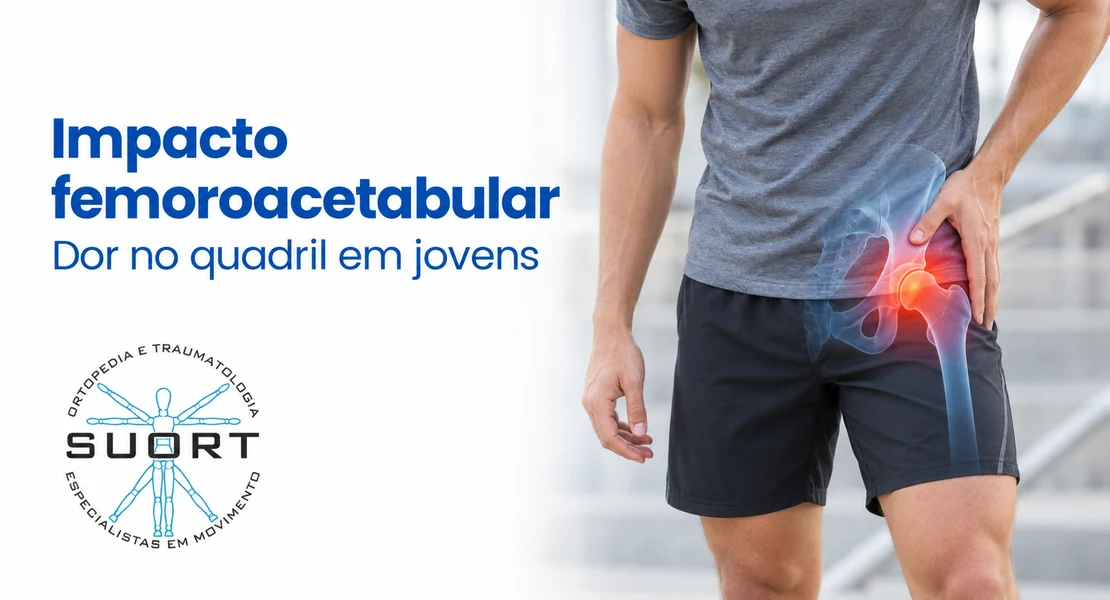 Impacto femoroacetabular, dor no quadril em jovens e atletas, avaliação com ortopedista e fisioterapia na SUORT Clínica Integrada, Perdizes, São Paulo