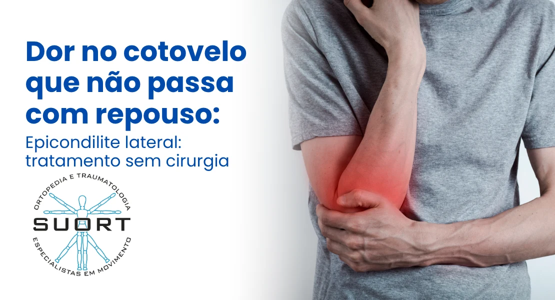 Pé com dor que queima entre os dedos  Neuroma de Morton tratamento ortopédico SUORT Clínica Integrada Perdizes São Paulo