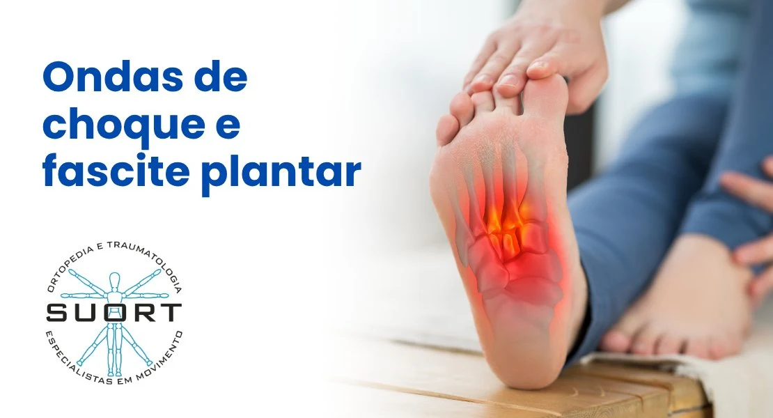 Terapia por ondas de choque para fascite plantar em São Paulo - SUORT Clínica Integrada, Perdizes