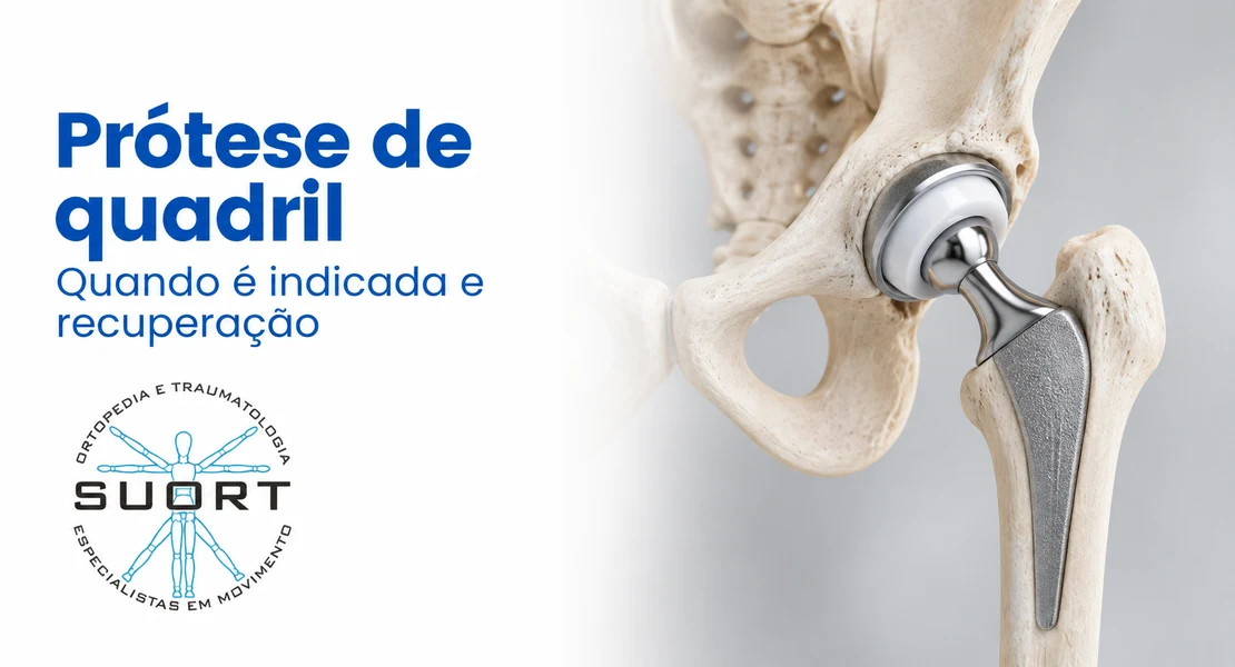 Prótese de quadril (artroplastia total de quadril), quando é indicada e recuperação, avaliação com ortopedista e fisioterapia na SUORT Clínica Integrada, Perdizes, São Paulo