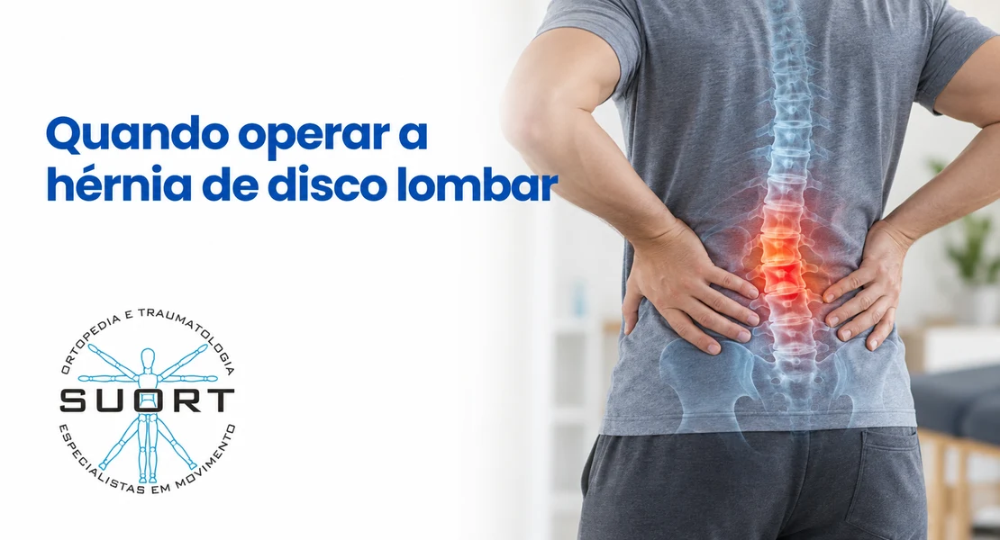 Quando operar hérnia de disco lombar, avaliação de dor ciática com equipe de coluna e fisioterapia na SUORT Clínica Integrada, Perdizes, São Paulo