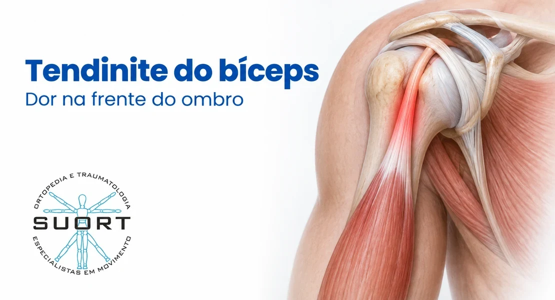 Tendinite do bíceps no ombro, dor na frente do ombro avaliada por ortopedista especialista na SUORT Clínica Integrada em Perdizes, São Paulo