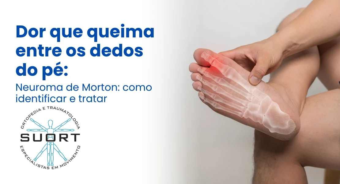 Mão com dor na base do polegar e pulso  tenossinovite de De Quervain tratamento ortopédico SUORT Clínica Integrada Perdizes São Paulo